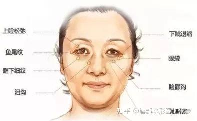 眼周抗衰解析丨科普篇 - 知乎