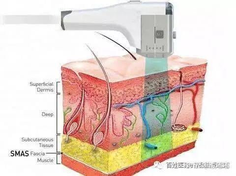 减肥手术有什么危害_手术减肥_减肥手术哪种效果好