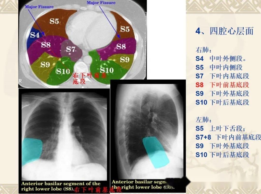 胸部ct读片技巧汇总 