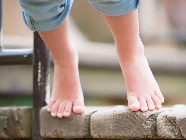 (一)儿童常见的足踝问题系列——高弓足 - 知乎