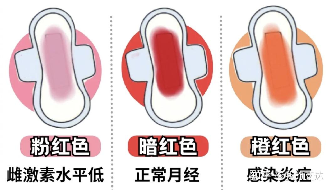 月经颜色竟然与女性健康状况密切相关! - 知乎