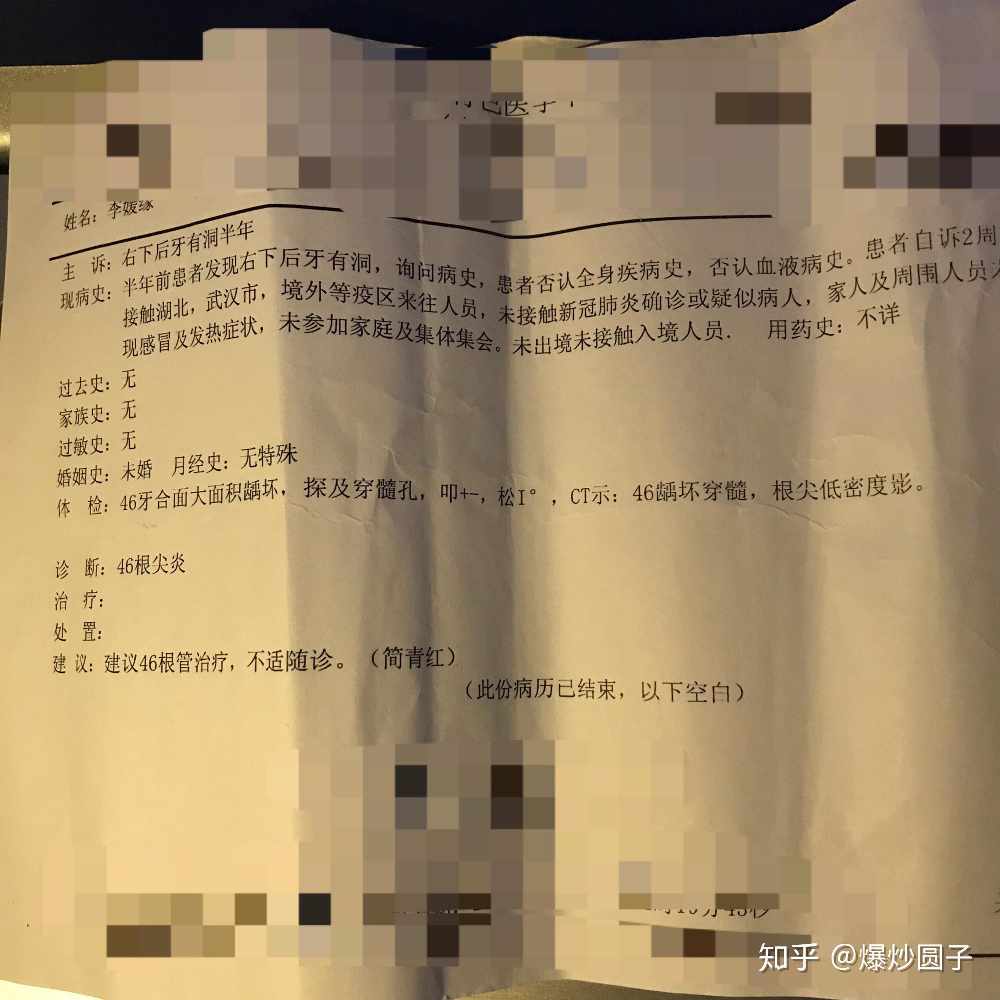 根管治疗疼不疼?分享我的真实看牙经历