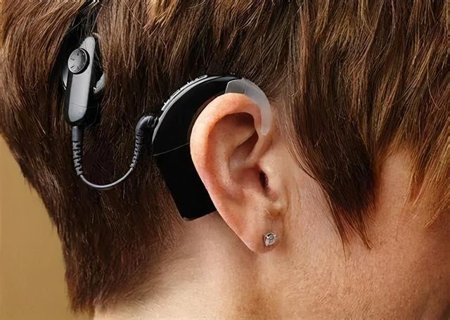 国产人工耳蜗帮助听障患儿告别无声世界