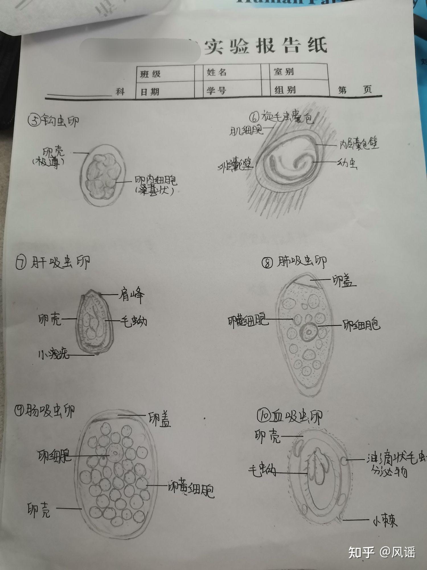 肠吸虫卵手绘图片