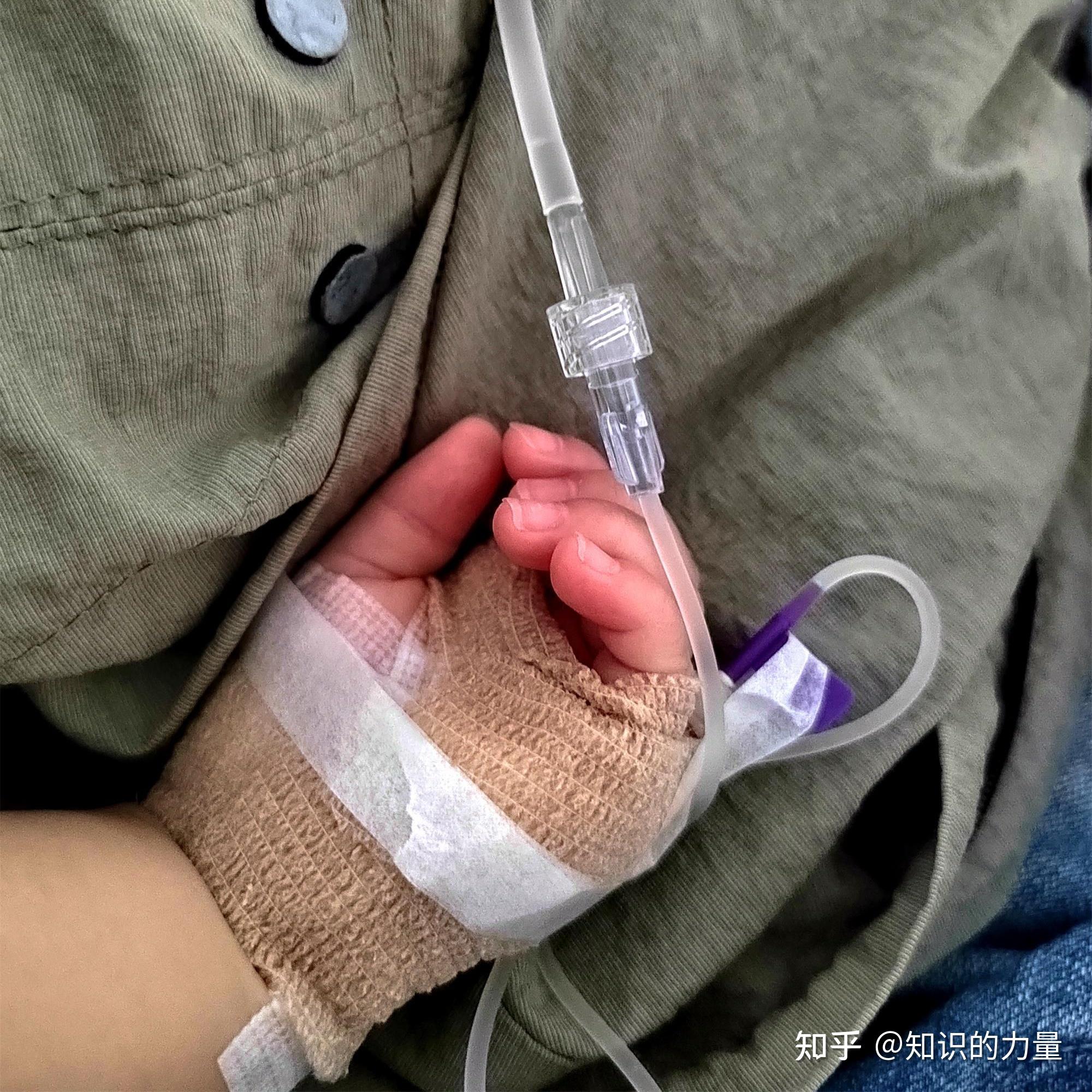  这次疫情治疗后有后遗症吗知乎(疫情治疗后的后遗症)