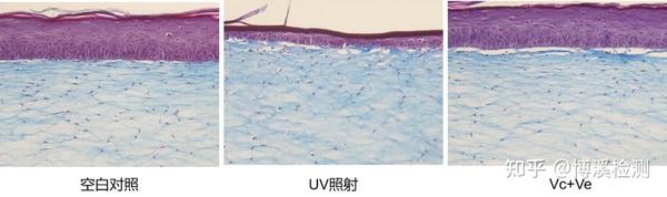 光与皮肤的故事——紫外线对皮肤的影响 - 知乎