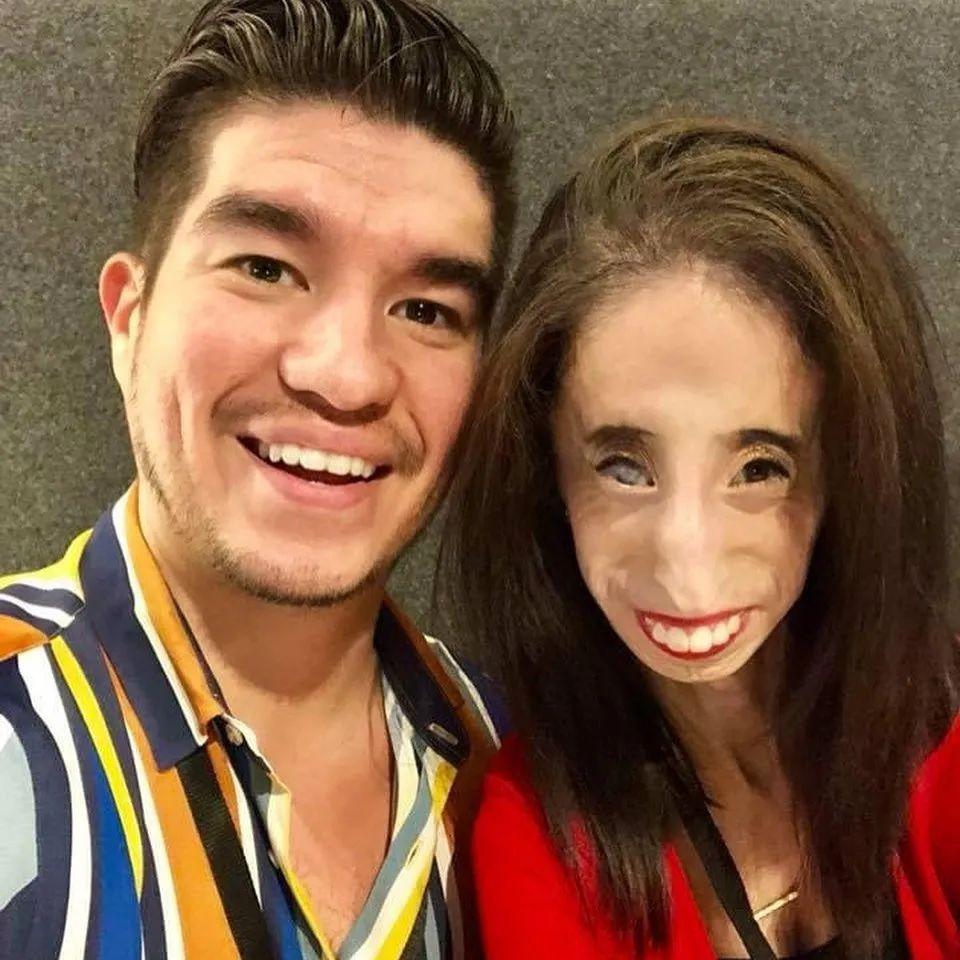 她被骂全世界最丑的女人却教会千万人美是什么