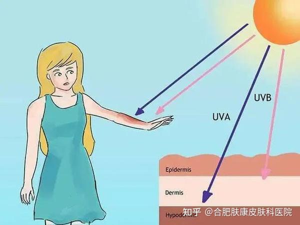 皮肤对“阳光”过敏?紫外线导致的这种皮肤病要小心! - 知乎
