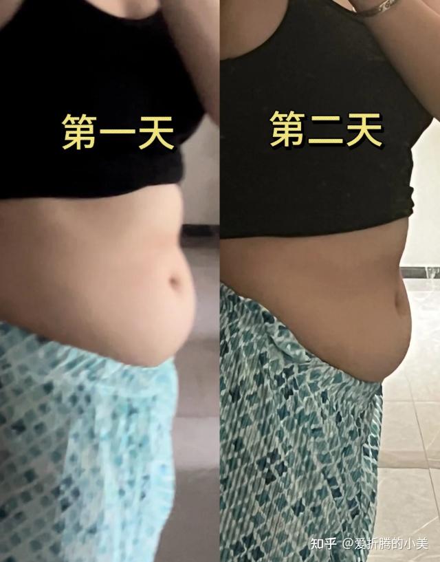 针灸变瘦的红利终于到我吃了! - 知乎