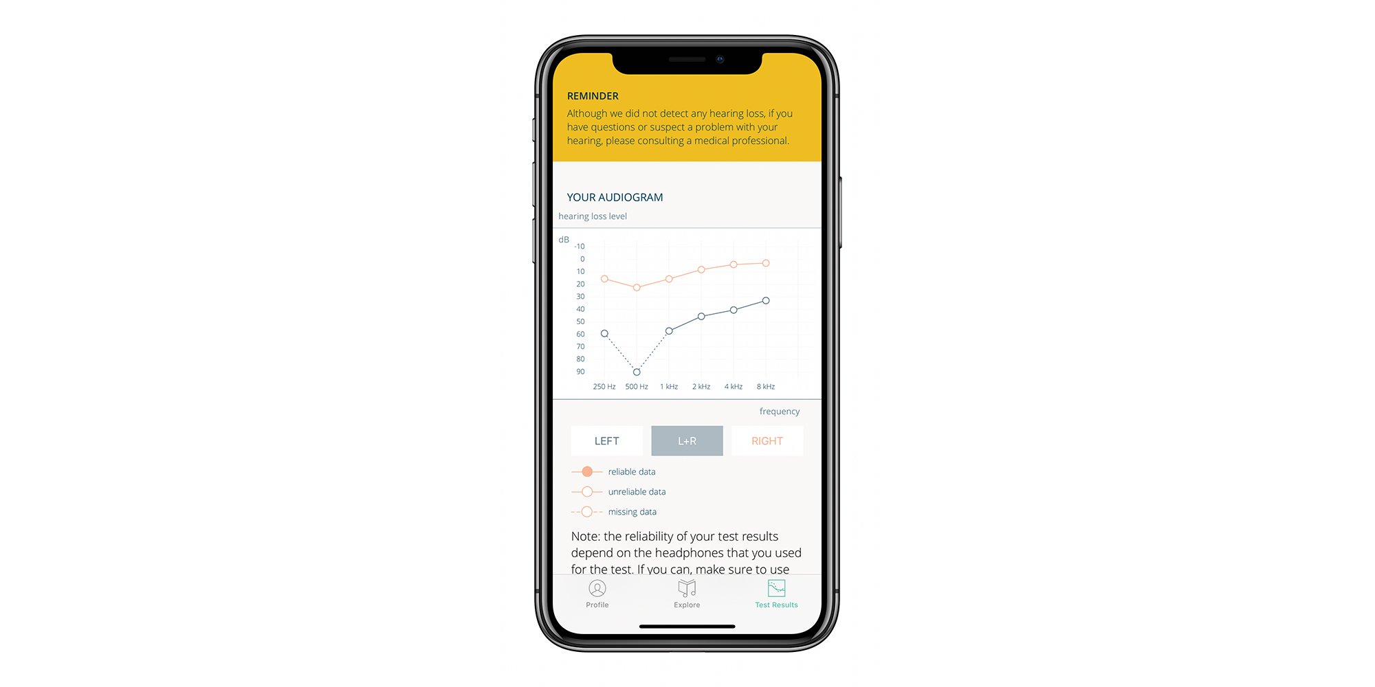 试试用这个 app 检测你的听力:mimi hearing test - 知乎