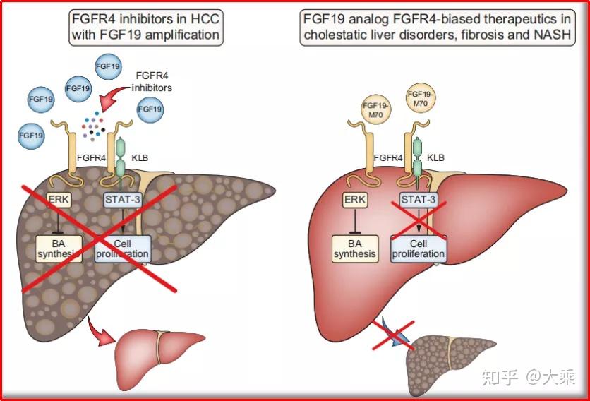 fgf19/fgfr4信号通路与原发性肝细胞肝癌(hcc)