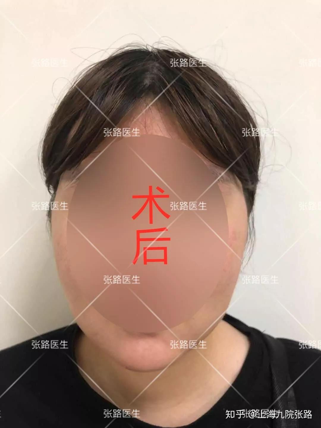 明星同款害惨了多少中国姑娘