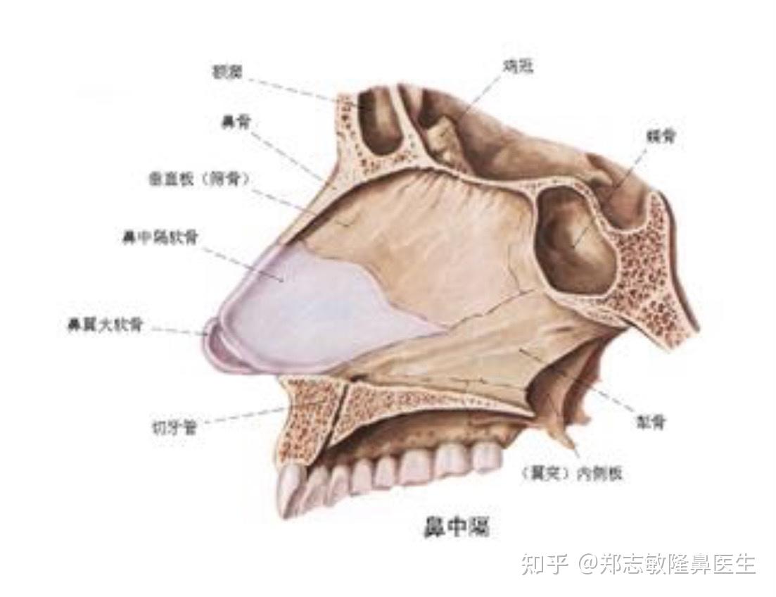 阐述一下鼻中隔偏曲和歪鼻的关系