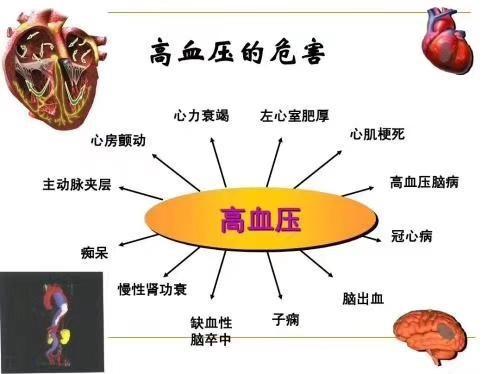 高血压必须知道的10件事 知乎