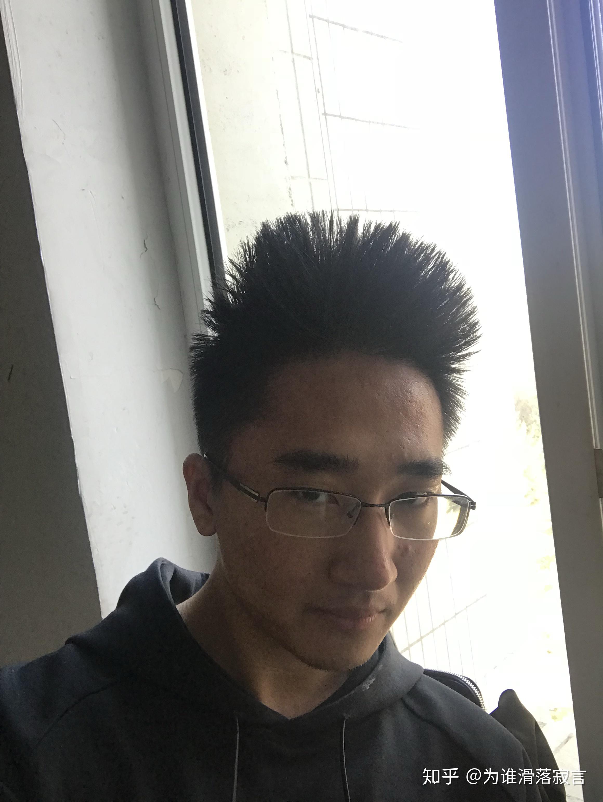 越长越丑是一种什么样的体验?