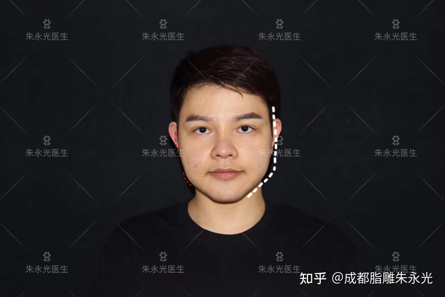 脸看起来方方正正怎么办?方脸如何变美? - 知乎