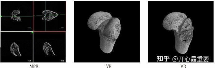 微焦点X射线CT系统(Micro-CT) - 知乎