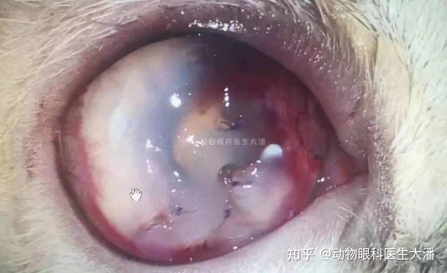 外院手术失败这边保守治疗后痊愈