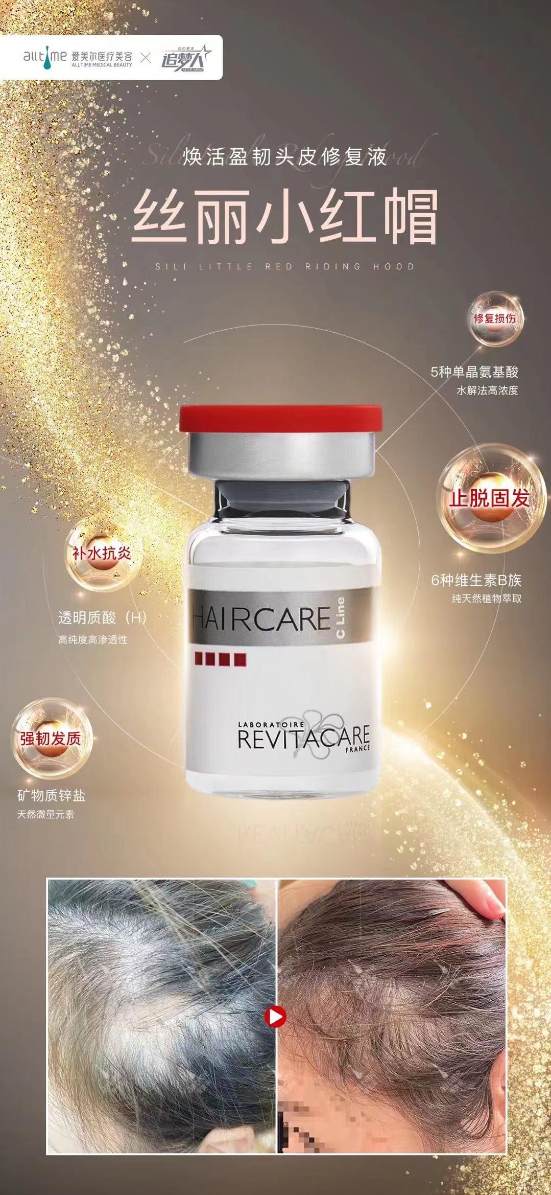 新生植发地址:杭州市拱墅区凤起路70号电话:400-666-7272丝丽小红帽