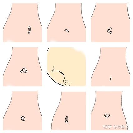 肚脐的形状图文解说图片