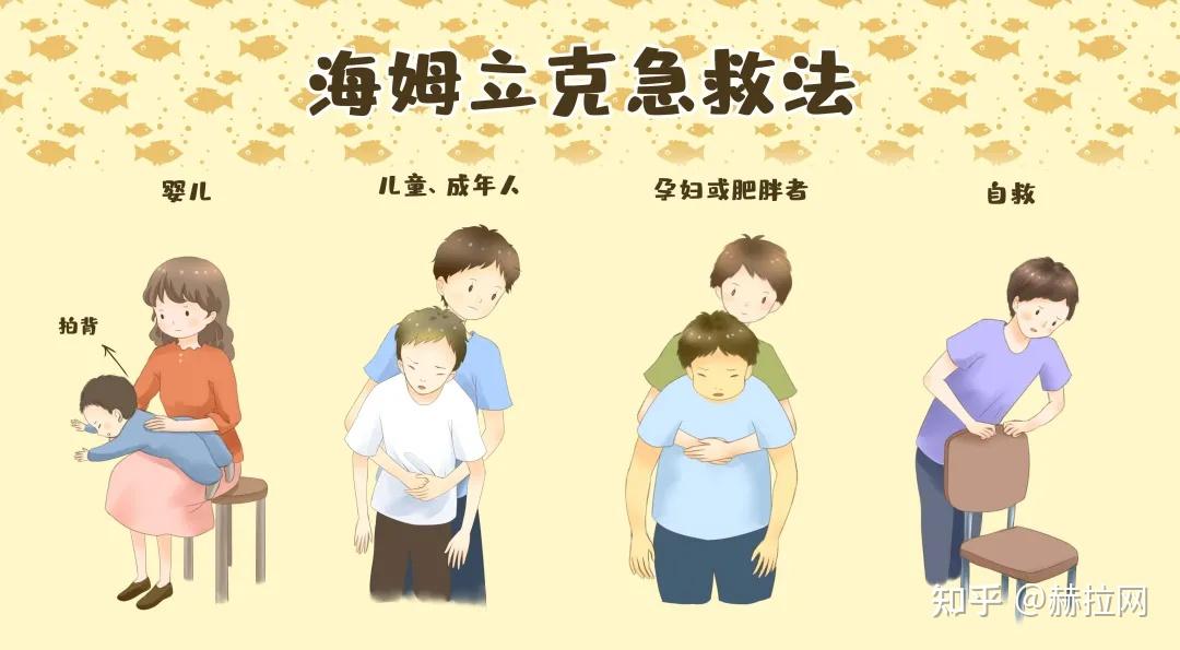 根据适应人群及方法的不同,一般将海氏急救法分为腹部冲击法,胸部冲击