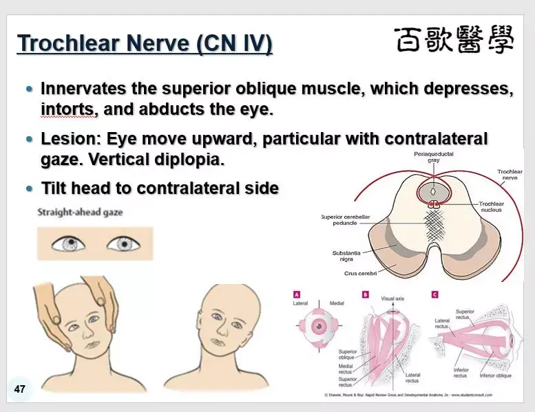 课件更新升级4眼球没转对吧脑干颅神经内容勘误