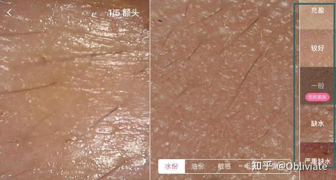 为啥一到春秋换季,皮肤就容易起皮爆皮,红敏刺痛? - 知乎