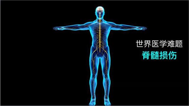 v2-81156ad5104a6efd8c6a5d34dd5c3260_1440w.jpg?source=172ae18b