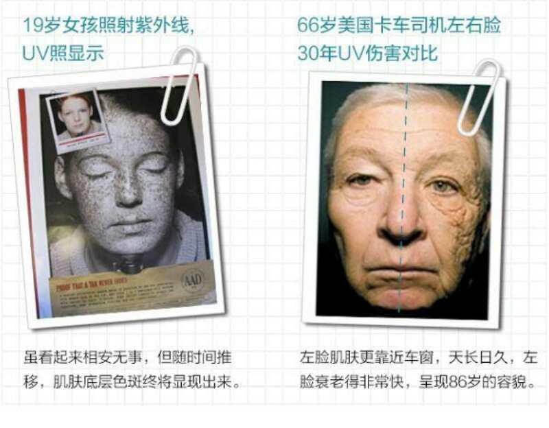 紫外线对人体肌肤造成的损伤危害