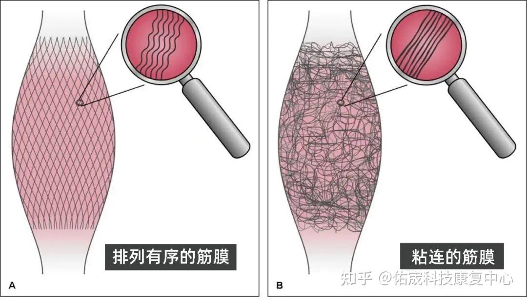 老化之后