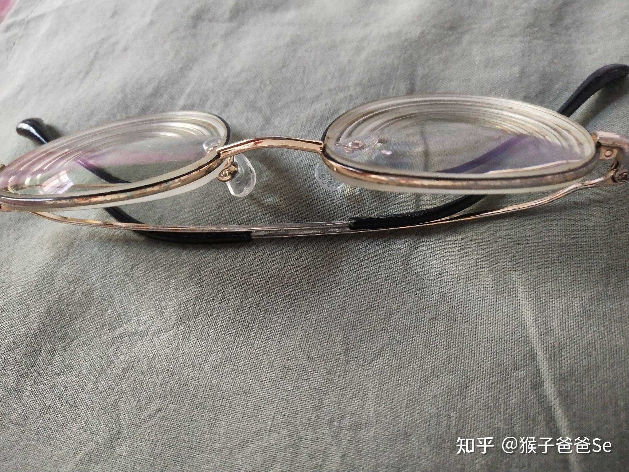 记录高度近视佩戴rgp硬性隐形眼镜日常