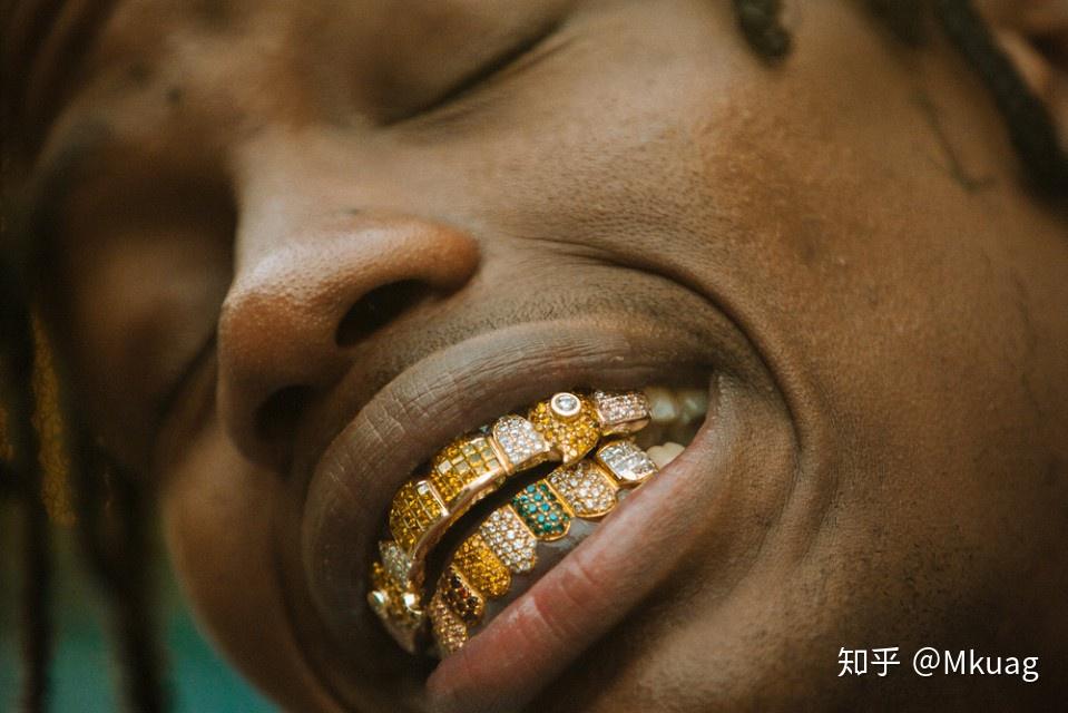 钻石牙套(或者其他一些宝石)的英文是grillz.
