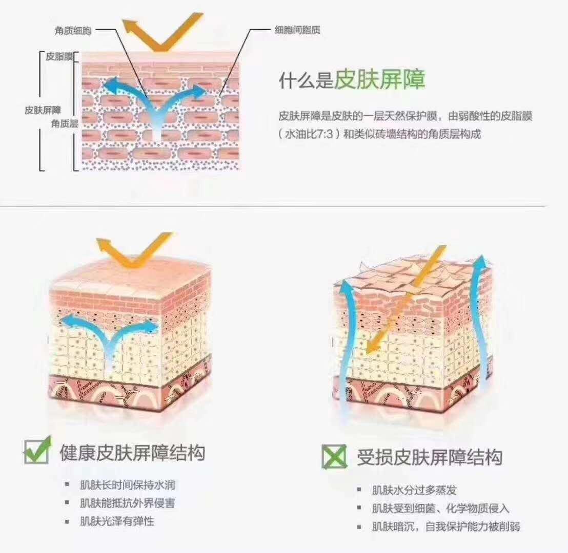 吃什么对皮肤屏障好 v2-81ca68d1ac5a1f4cea19bedd25b0e30f_1440w.jpg?source=172ae18b