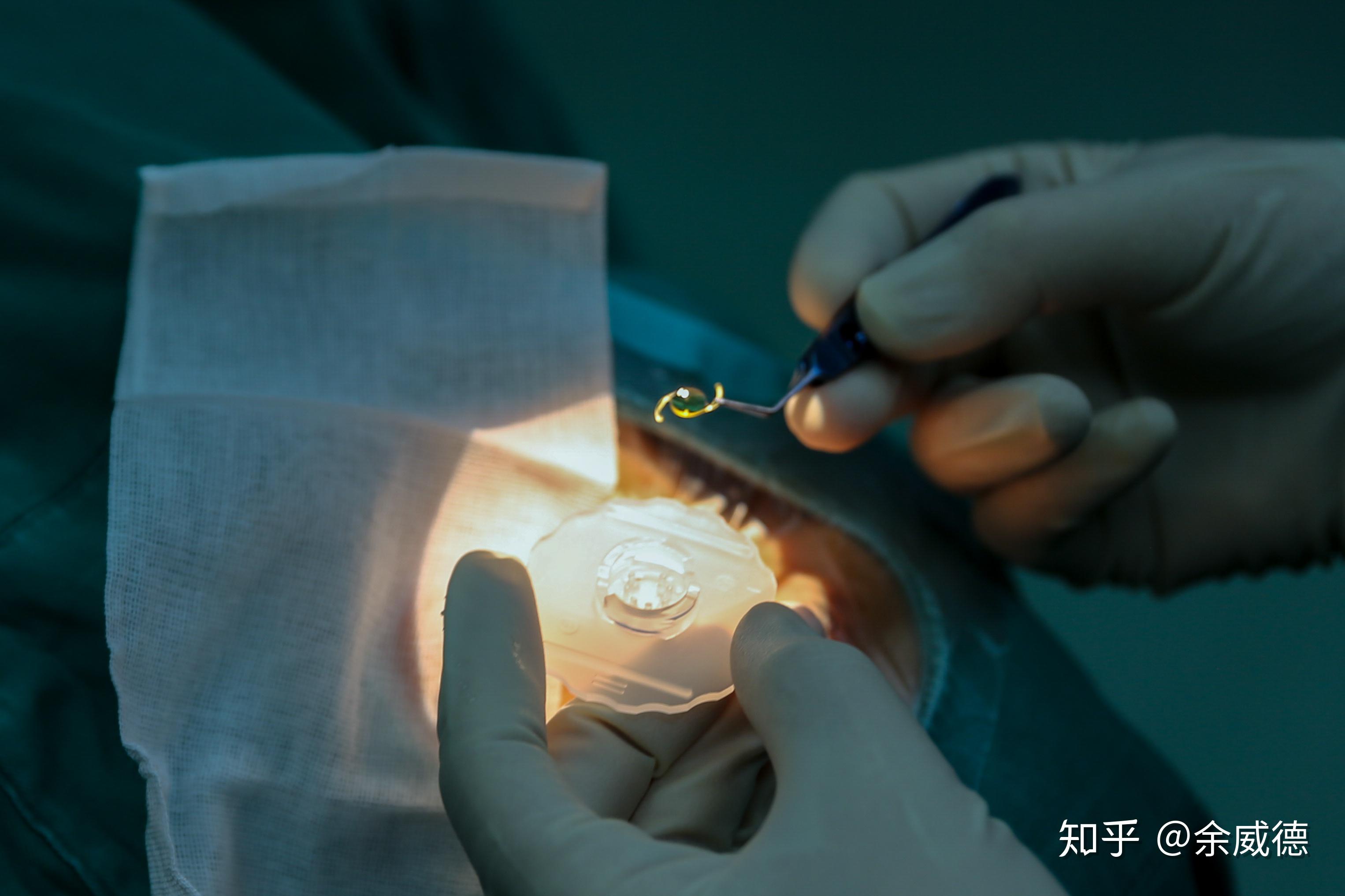 太学眼科首例新一代爱尔康三焦人工晶体植入术引领精准老花白内障矫治