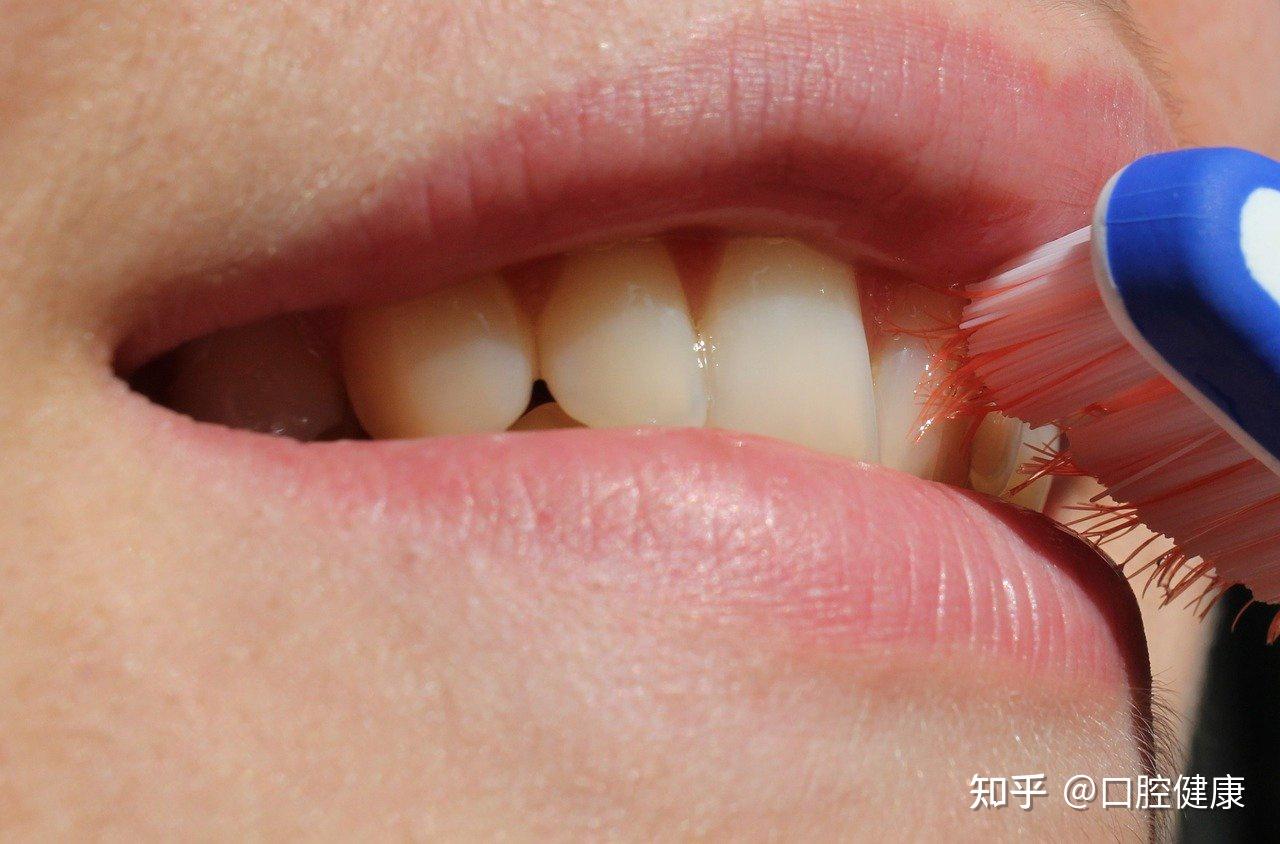 牙周炎的症状表现 常见的牙周炎有哪些表现 - 学堂在线健康网