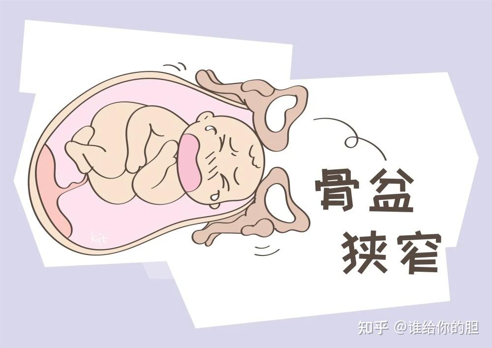 为什么孕妈们“开十指”有快有慢? - 知乎