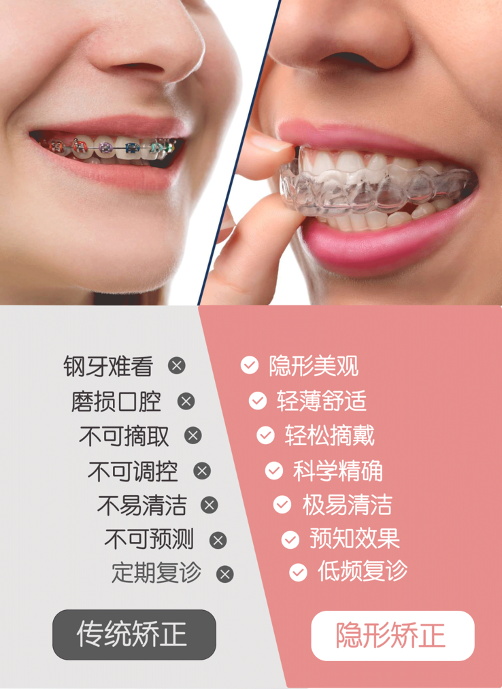 矫正方法怎么选?