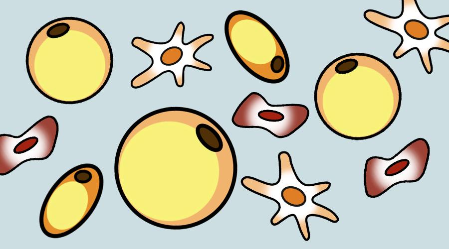 脂肪一张图读懂大颗粒脂肪小颗粒脂肪纳米脂肪脂肪胶的区别