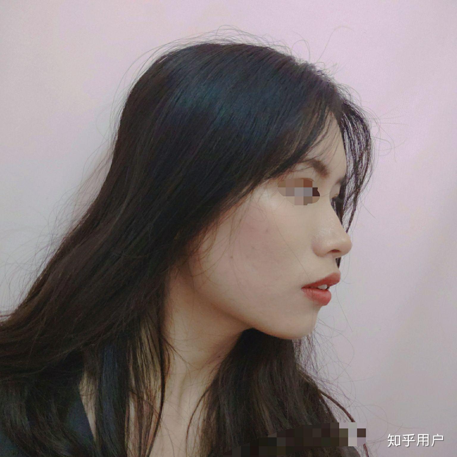 存在凸嘴的美女吗?