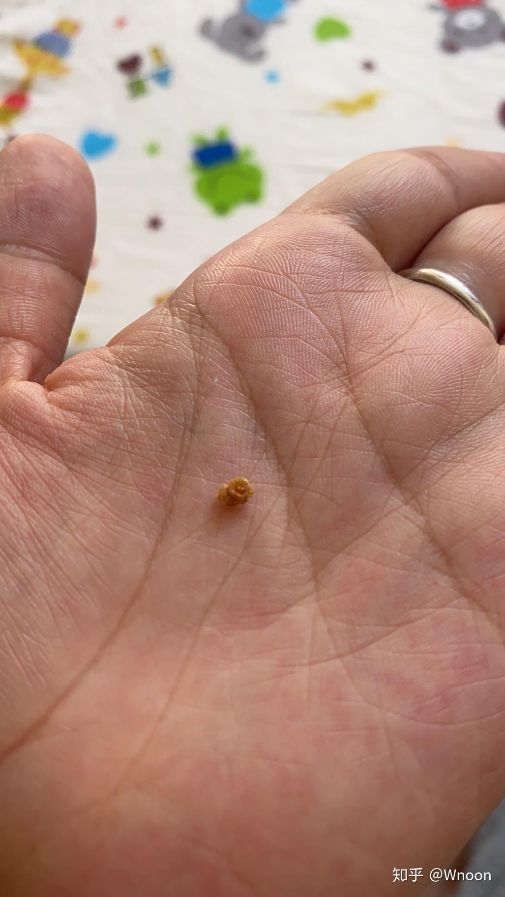 孩子的耳屎真的会很多, - 知乎