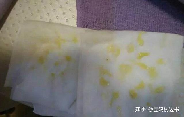 不排残奶会致癌不排残奶影响二胎哺乳这些知识你该知道了