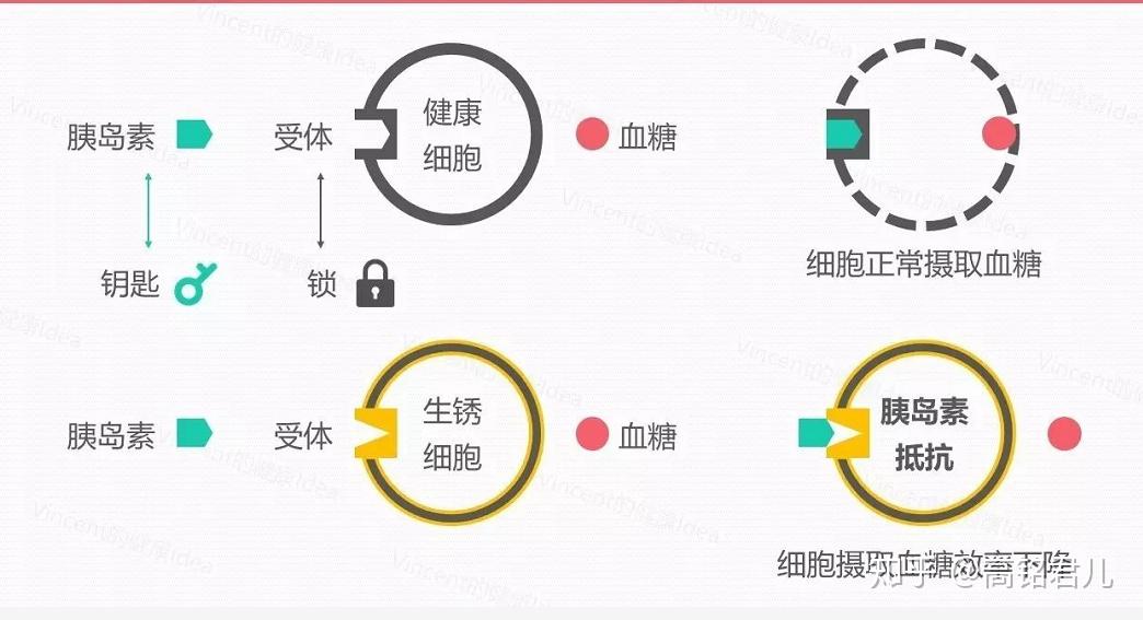 如何改善和逆轉胰島素抵抗了解2型糖尿病的發病機制