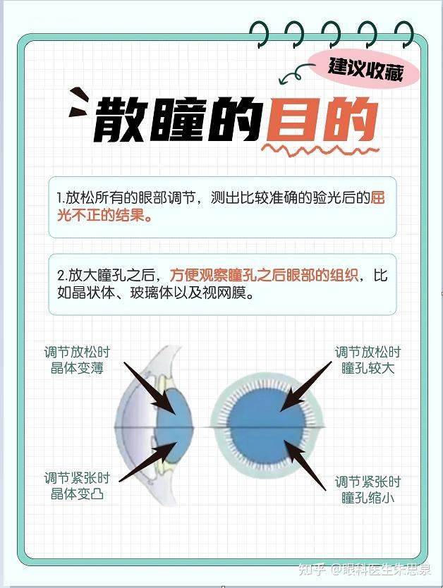 一文读懂散瞳到底是什么？ - 知乎