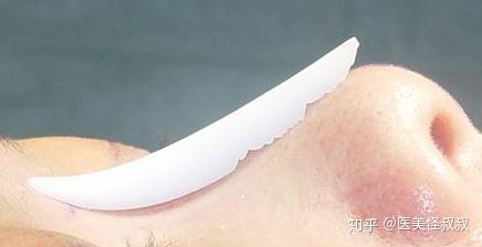 暴力亲热隆鼻后鼻子假体会撞歪