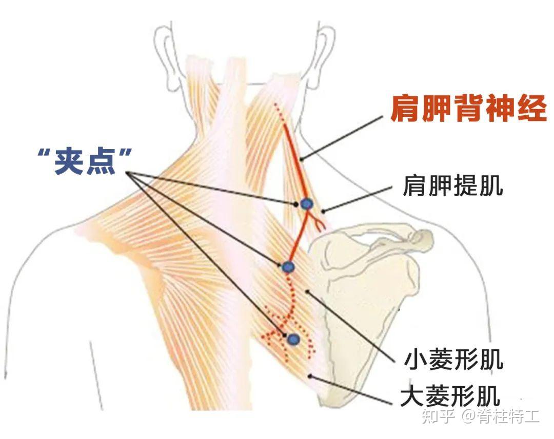 肩胛骨图解大全高清图片