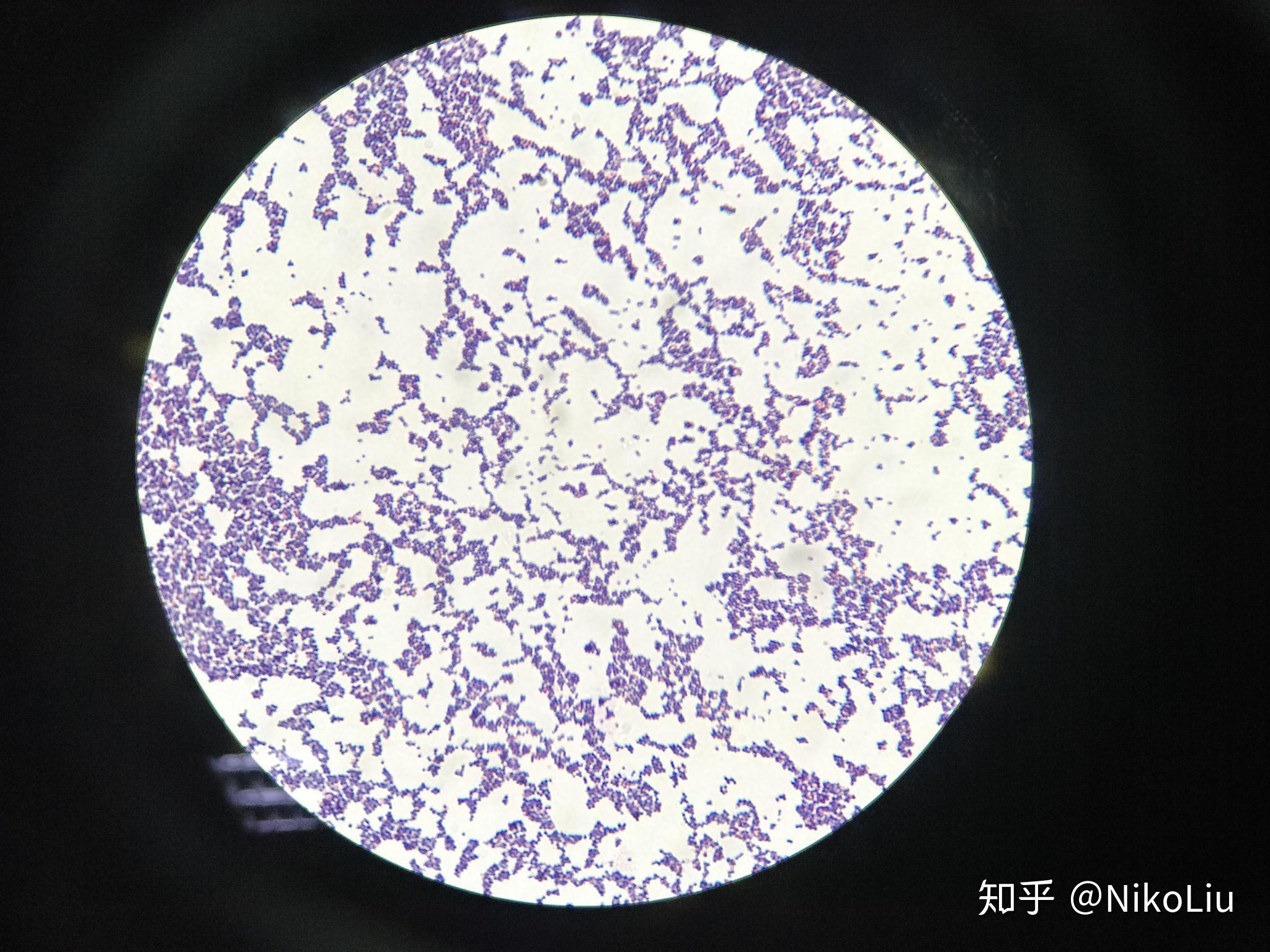 常见细菌可以用普通光学显微镜看到吗