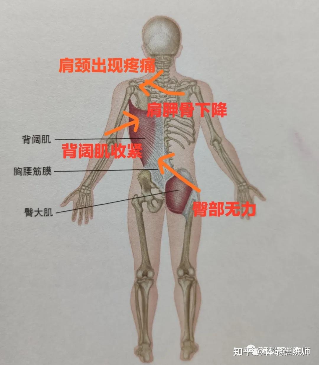 阔背肌疼图片