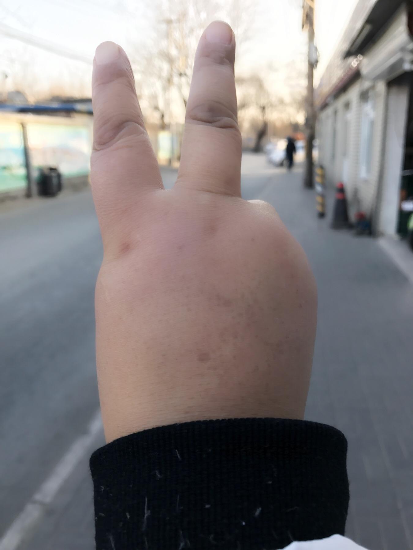 女生的手长得比男生还丑,又短又粗是怎样一种体验 ? - 知乎