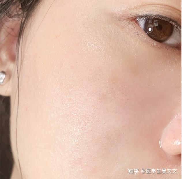 怎么才能去法令纹 v2-83646421b3e98eeeb89a18aad5c5c8f5_r.jpg