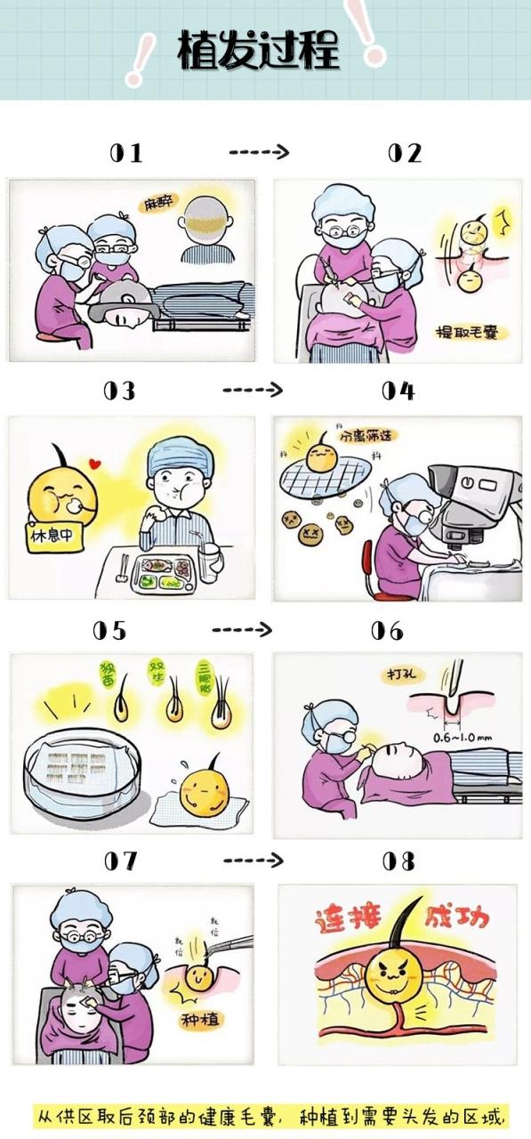 植发前你需要了解的事(一)植发流程解答